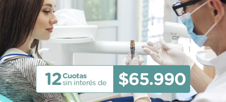 IMPLANTE DENTAL UNITARIO