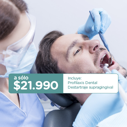 HIGIENE DENTAL