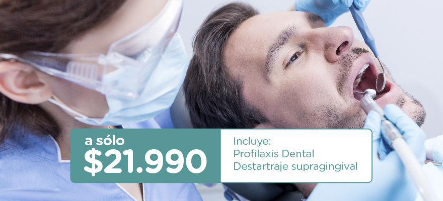 HIGIENE DENTAL