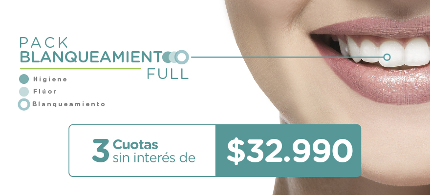 BLANQUEAMIENTO DENTAL