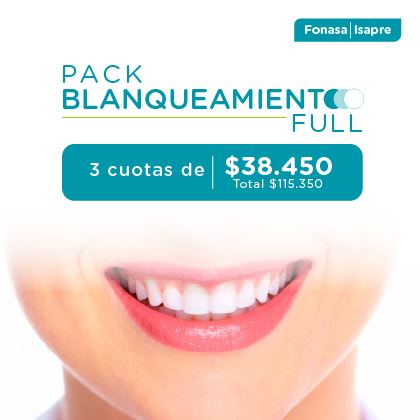 BLANQUEAMIENTO DENTAL
