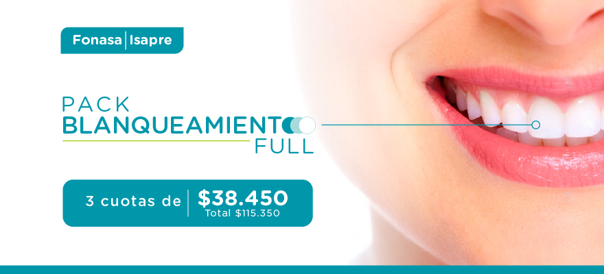 BLANQUEAMIENTO DENTAL