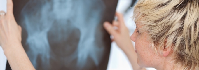 traumatología de cadera RedSalud