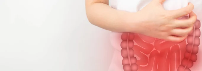 Colon Irritable