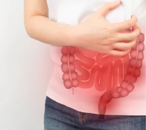 Colon Irritable