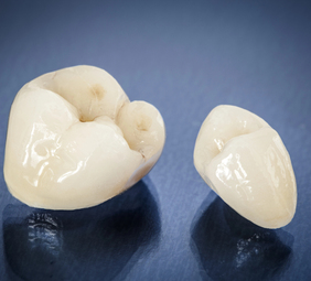 corona dental