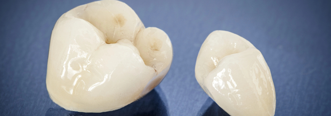 corona dental