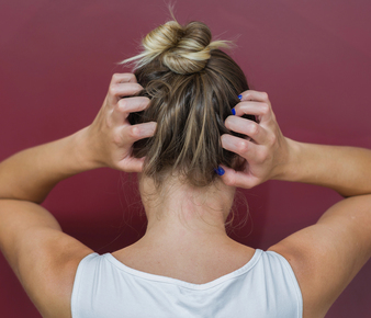 persona con dermatitis seborreica en el cuero cabelludo