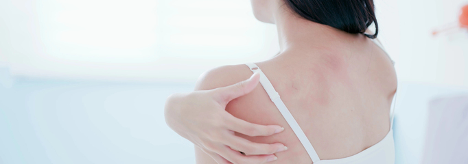 tratamiento dermatitis