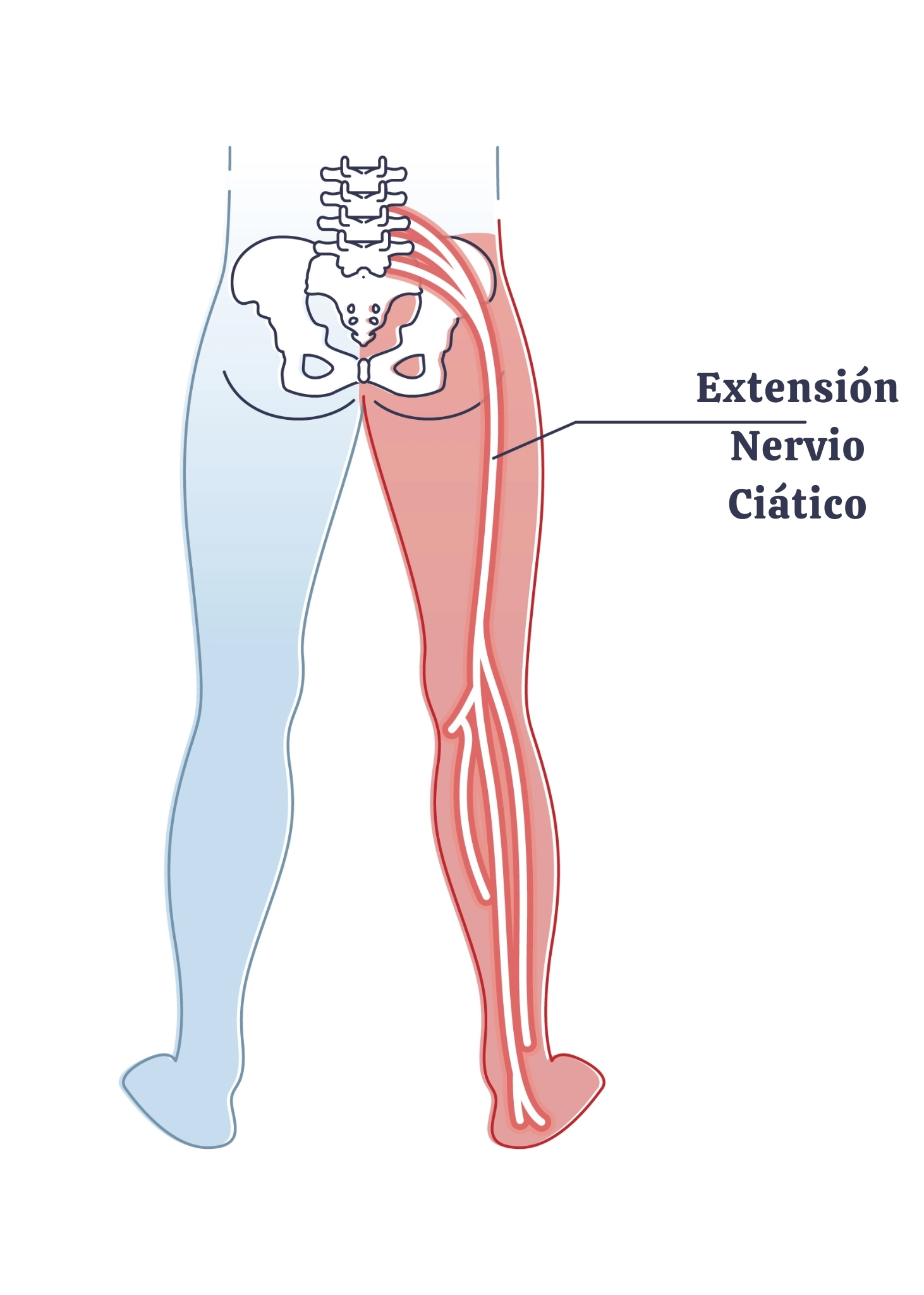 Ilustración que muestra la extensión del nervio ciático