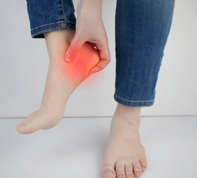 Fascitis plantar
