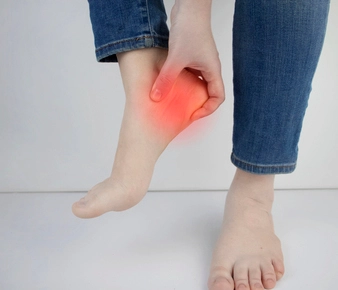 Fascitis plantar