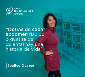 Testimonio de abodminoplastia bono pad