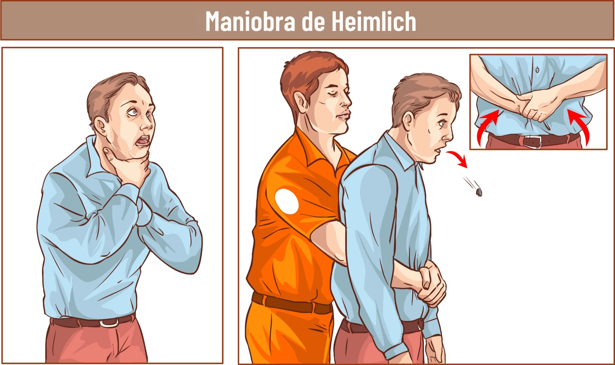 ilustración maniobra de heimlich
