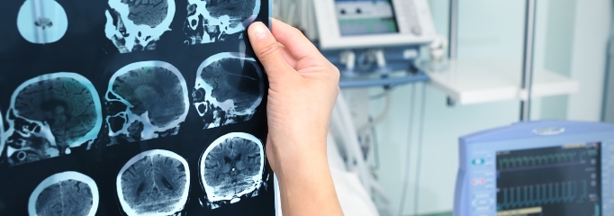 mano de especialista sostiene unas imágenes de cerebro