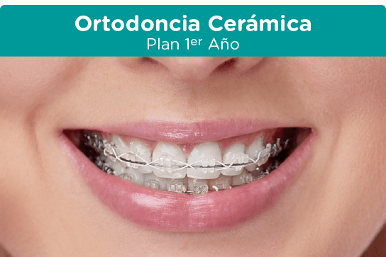 ortodoncia ceramica