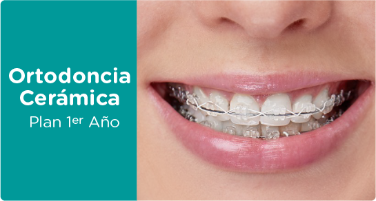 ortodoncia brackets ceramica