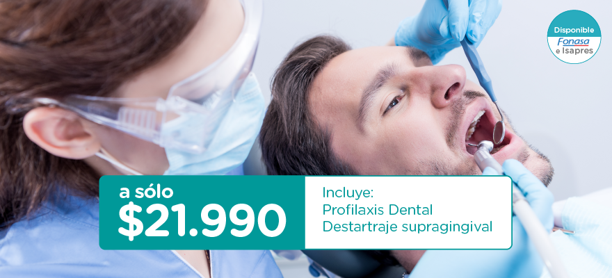 HIGIENE DENTAL