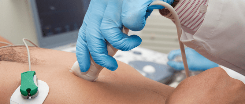ECOCARDIOGRAMA DOPPLER COLOR