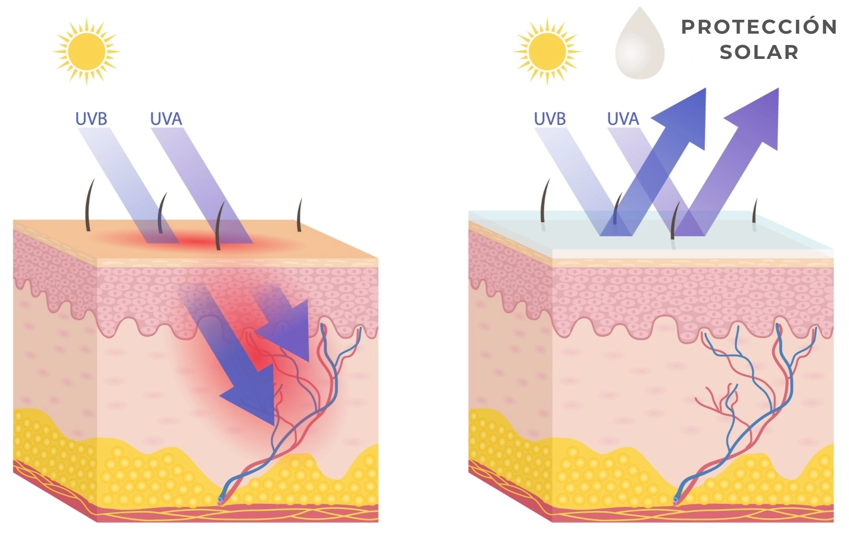 ilustración que muestra como actúa un protector solar