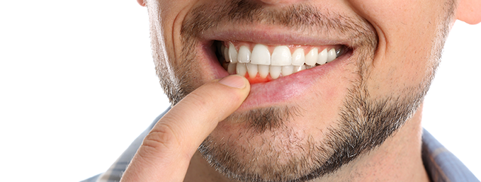 salud dental RedSalud