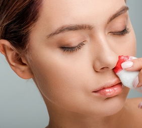 persona con sangrado nasal