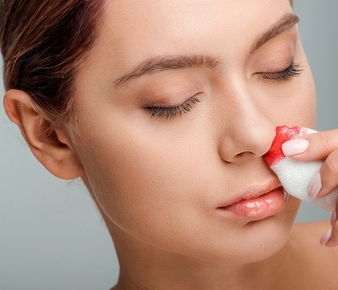 persona con sangrado nasal