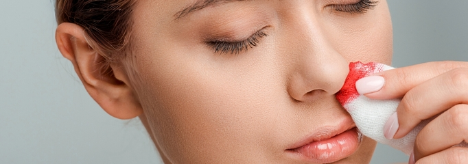 persona con sangrado nasal