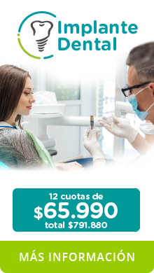 Implante dental RedSalud